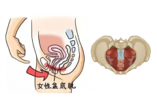 了解盆底肌，才知道它有多重要！